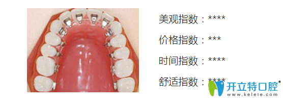 北京康貝佳口腔舌側(cè)隱形矯正技術(shù)