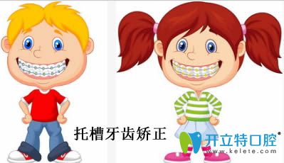 開立特口腔托槽牙齒矯正動(dòng)畫圖