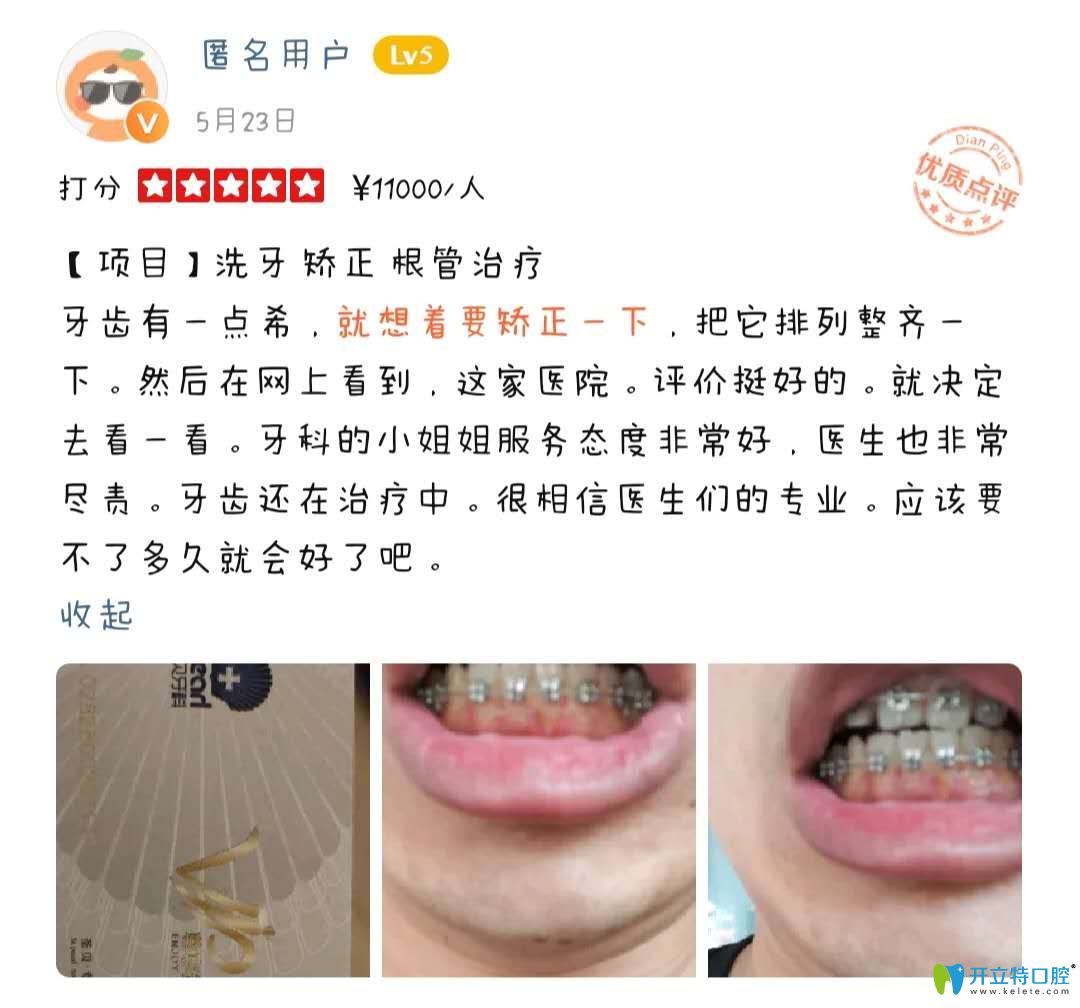 網(wǎng)友評價在網(wǎng)上看到圣貝矯正好評后決定到圣貝做正畸