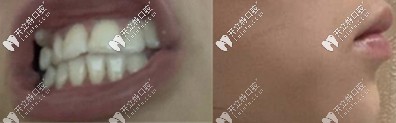 求助,望京這家牙科金屬自鎖和非自鎖牙套的收費(fèi)價(jià)格合理嗎