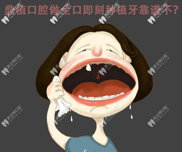 誰做過即刻種植牙啊,在上海鼎植口腔做這種全口的靠譜不